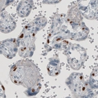 Immunohistochemical staining of human placenta shows nuclear positivity in a subset of cells.