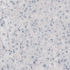 Immunohistochemical staining of human liver shows absence of immunoreactivity (negative control).