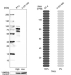 Western blot analysis in human cell line RT-4 and human cell line U-251 MG.