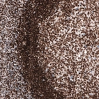 Immunohistochemical staining of human tonsil shows strong nuclear membrane positivity in lymphoid cells.