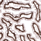 Immunohistochemical staining of human small intestine shows strong nuclear membrane positivity in glandular cells.