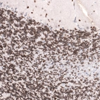 Immunohistochemical staining of human cerebellum shows strong nuclear membrane positivity in cells in granular layer.