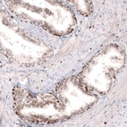 Immunohistochemical staining of human prostate shows moderate nuclear membrane positivity in glandular cells.