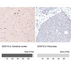 Anti-SOX10 Antibody