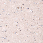 Immunohistochemical staining of human cerebral cortex shows strong nuclear positivity in glial cells (oligodendrocytes).