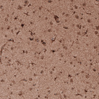 Immunohistochemical staining of human cerebral cortex shows strong cytoplasmic positivity in a subset of cells as well as moderate immunoreactivity in neuropil.