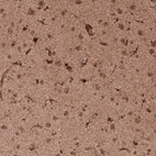 Immunohistochemical staining of human cerebral cortex shows strong cytoplasmic positivity in a subset of cells as well as moderate immunoreactivity in neuropil.