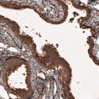 Immunohistochemical staining of human fallopian tube shows strong granular cytoplasmic immunoreactivity in glandular cells.