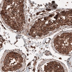 Immunohistochemical staining of human testis shows strong cytoplasmic positivity in cells in seminiferous tubules.
