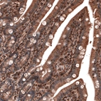 Immunohistochemical staining of human duodenum shows strong cytoplasmic immunoreactivity in glandular cells and in lymphoid cells.