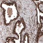 Immunohistochemical staining of human prostate shows strong cytoplasmic positivity in glandular cells.