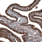 Immunohistochemical staining of human fallopian tube shows strong granular cytoplasmic positivity in glandular cells.