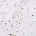 Immunohistochemical staining of human skeletal muscle shows only weak cytoplasmic positivity in muscle fibers.
