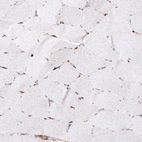 Immunohistochemical staining of human skeletal muscle shows only weak cytoplasmic positivity in muscle fibers.