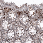 Immunohistochemical staining of human rectum shows granular cytoplasmic immunoreactivity in glandular cells and in lympohoid cells.