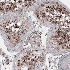 Immunohistochemical staining of human testis shows cytoplasmic positivity in cells in seminiferous tubules.