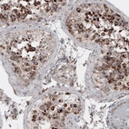 Immunohistochemical staining of human testis shows cytoplasmic positivity in cells in seminiferous tubules.