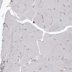 Immunohistochemical staining of human skeletal muscle shows only weak cytoplasmic positivity in muscle fibers.