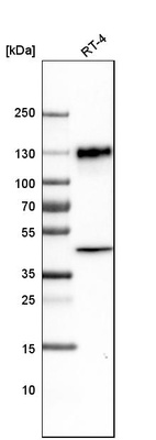 Western blot analysis in human cell line RT-4.