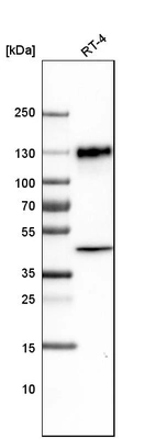 Western blot analysis in human cell line RT-4.