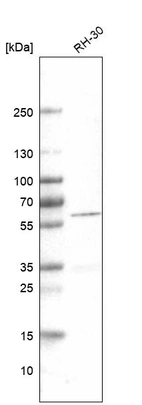 Anti-DES Antibody