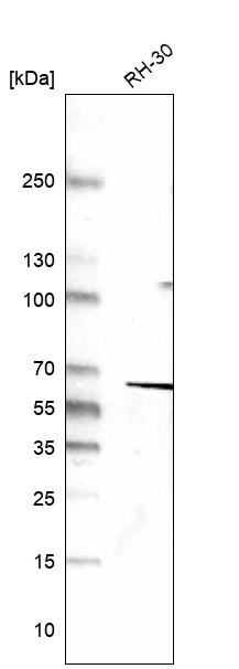 Anti-DES Antibody