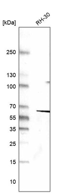 Anti-DES Antibody