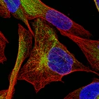Immunofluorescence staining of RH-30 cells using the Anti-DES monoclonal antibody, showing specific staining of intermediate filaments in green. Microtubule- and nuclear probes are visualized in red and blue, respectively (where available).
