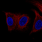 Anti-DES Antibody