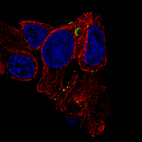 Anti-GJB6 Antibody