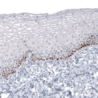 Immunohistochemical staining of human skin shows moderate to strong nuclear positivity in basal cell layer.