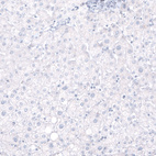 Immunohistochemical staining of human liver shows no positivity in hepatocytes as expected.