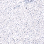 Immunohistochemical staining of human liver shows no positivity in hepatocytes as expected.