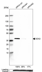 Western blot analysis in U-251MG cells transfected with control siRNA, target specific siRNA probe #1 and #2, using Anti-SOX2 antibody. Remaining relative intensity is presented. Loading control: Anti-PPIB.