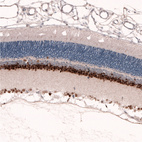 Anti-PAX6 Antibody