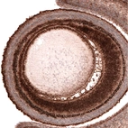 Immunohistochemical staining of mouse embryo E14 shows strong nuclear positivity in the developing eye.