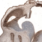 Immunohistochemical staining of mouse embryo E11 shows strong nuclear positivity in the developing brain and sensory organs.