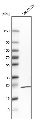 Anti-RGS5 Antibody