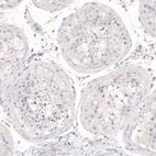 Immunohistochemical staining of human testis shows absence of positivity in seminiferous ducts as expected (negative control).