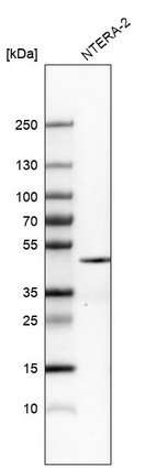 Western blot analysis in human cell line NTERA-2.