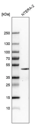 Western blot analysis in human cell line NTERA-2.