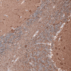 Anti-TUBB3 Antibody