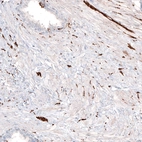Immunohistochemical staining of human prostate shows strong positivity in the peripheral nerves.
