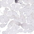 Immunohistochemical staining of human skeletal muscle shows absence of positivity in striated muscle fibers as expected (negative control).