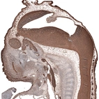 Immunohistochemical staining of mouse embryo E11 shows strong positivity in the developing central and peripheral nervous system.