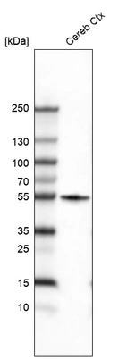 Western blot analysis in human cerebral cortex tissue.