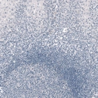 Immunohistochemical staining of human tonsil shows absence of immunoreactivity as expected (negative control).