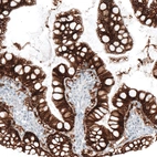 Immunohistochemical staining of human small intestine shows strong membranous positivity in glandular cells.
