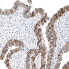 Immunohistochemical staining of human fallopian tube shows moderate membranous positivity in glandular cells.