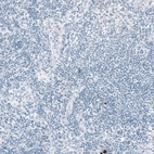 Immunohistochemical staining of human lymph node shows no positivity in lymphoid cells as expected.